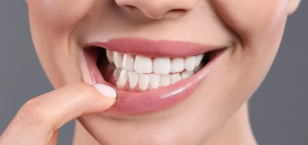 dentiste facettes dentaires l isle adam Parodontite : la maladie des gencives Dr Ludovic Zeitoun - Chirurgien-dentiste à L'Isle-Adam