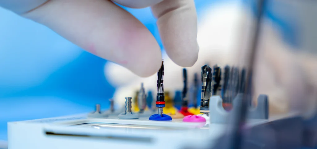 chirurgien dentiste caries l isle adam Dévitalisation Dr Ludovic Zeitoun - Chirurgien-dentiste à L'Isle-Adam