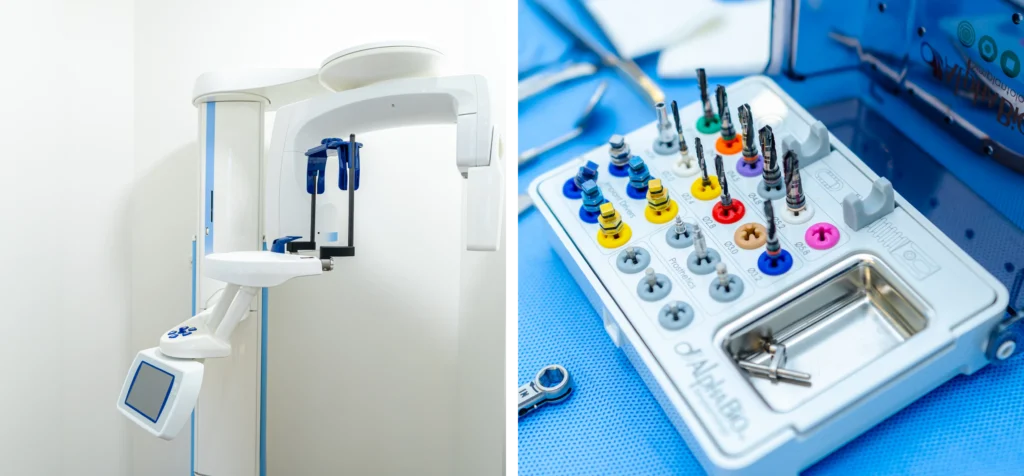 chirurgien dentiste implants l isle adam x Soins des caries Dr Ludovic Zeitoun - Chirurgien-dentiste à L'Isle-Adam