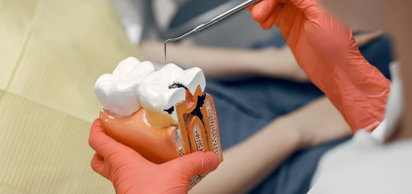 traitements dentaires gencives l isle adam Soins des caries Dr Ludovic Zeitoun - Chirurgien-dentiste à L Isle-Adam